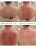 【最強拝毒☆】漢方アロマ×全身リセットリンパ110分16,300→12,900【発汗!】