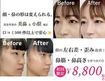 ラプリ 新宿店(Raplit)