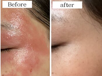 ソナミオール(SonaMior)