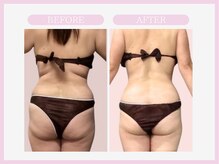 アコガレコガオ 山形店/