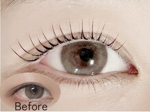 まぶたのたるみなどお悩み解消★『モチが全然違う』と大好評◎