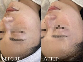 サロンブランシュ(salon BLANCHE)/艶肌WAX＋CHRISTINA