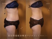 セオリー(Theory)の雰囲気（【脂肪撃退痩身】大幅なサイズダウンも気になる部分だけもOK！）