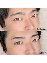 ダリ(Dali)/メンズハリウッドブロウリフト