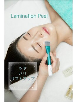 アベニール(AveniR)/ラミネーションピール