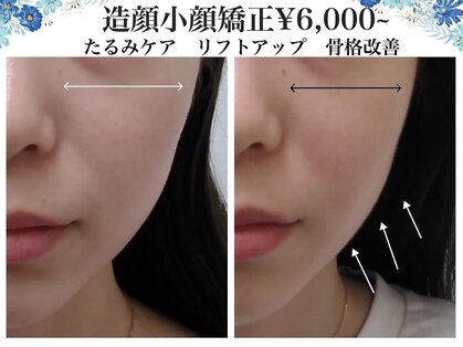 美人ヶ丘の写真