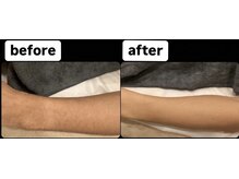 ゴッド(GOD)/ビフォーアフター