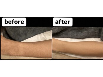 ゴッド(GOD)/ビフォーアフター