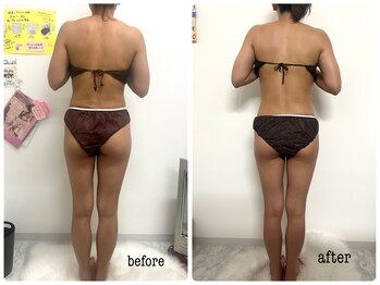 シャルム(Charme)/