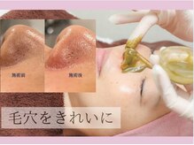 MMKの雰囲気（ハーブピーリングで毛穴がつるん☆ファンデが吸い付く♪）