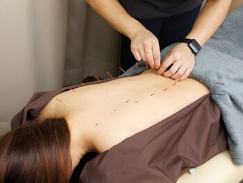 大宮ウィル鍼灸整骨院/全身・痛みに即効の鍼灸施術!