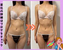 ベルフェム(Bellefemme)