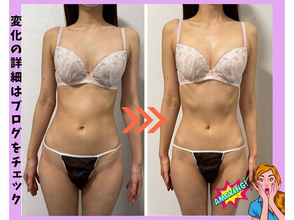 ベルフェム(Bellefemme)の写真