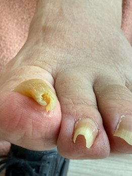 爪の悩みを解消できる（ケア含む）