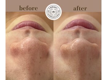 ユーアンドハニー(U&Honey.)/よもぎ蒸し＋ハーブうるつや美白