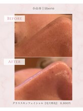 リベルテ(Liberte)/20代後半｜インナードライ
