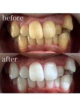 サロンエル(SALON el)/◇歯と肌の専門店◇サロンエル