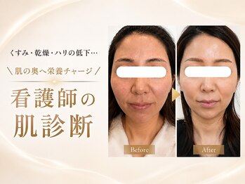 エン 橿原店(en)の写真/最近、肌がなんとなく冴えない…。くすみ・乾燥・ハリ不足に、看護師が必要な美肌ケアをご提案します。