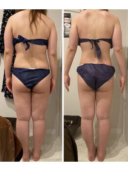 エステサロン ブレス 山形店(BLESS)/痩身結果