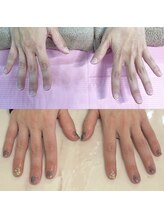 ハッカネイル(HAKKA NAIL)/