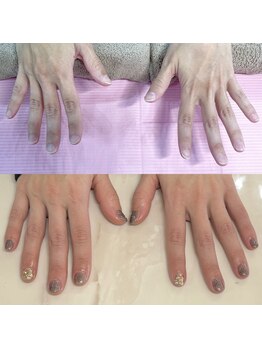 ハッカネイル(HAKKA NAIL)/