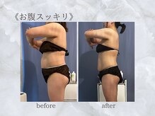 ジュプン 長崎/人気Ｎｏ．1筋膜リリース★