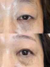 ダーム ド ローズ(Dame de rose)/【まぶたが上がるまつ毛パーマ】