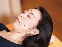 はぐくみ鍼灸整骨院