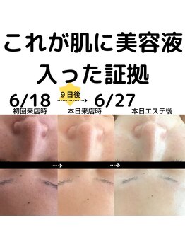 ブルーバケーション(Blue Vacation)/