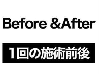 エレヴィザ トウキョウ 恵比寿院(ELVISA TOKYO)/小顔矯正/骨盤矯正/恵比寿渋谷