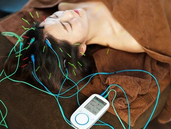 リケア鍼灸院 渋谷駅前(reCare)の写真/眼精疲労を解消したい方必見!頭への鍼刺激が心地よい『ハリミン』でリフレッシュ♪