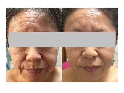 レジュイール(Rejouir)の写真