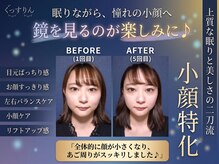 ぐっすりんの雰囲気(眠りと小顔を伴走サポート!続けるほど、鏡を見るのが楽しみに♪)