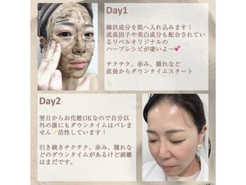 ノーブル 新宿南口(NOBLE)/ダウンタイムの様子