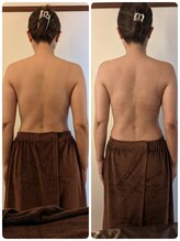 エル(eL)/Before/After