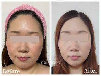 ダルセーニョ/【論より証拠！】◎１１回目です