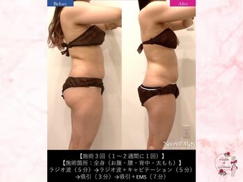 サロンドモアロ(Salon de Moaro)/Before/After