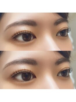 コレットアイビューティー(COLLET EYE BEAUTY)/