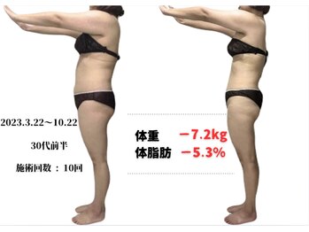 ラヴィ アール(Lavie.R)/痩身/リンパ/リンパマッサージ