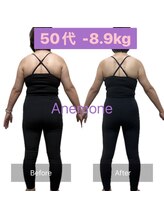 アネモネ/ダイエット/痩身/耳つぼ/腸活