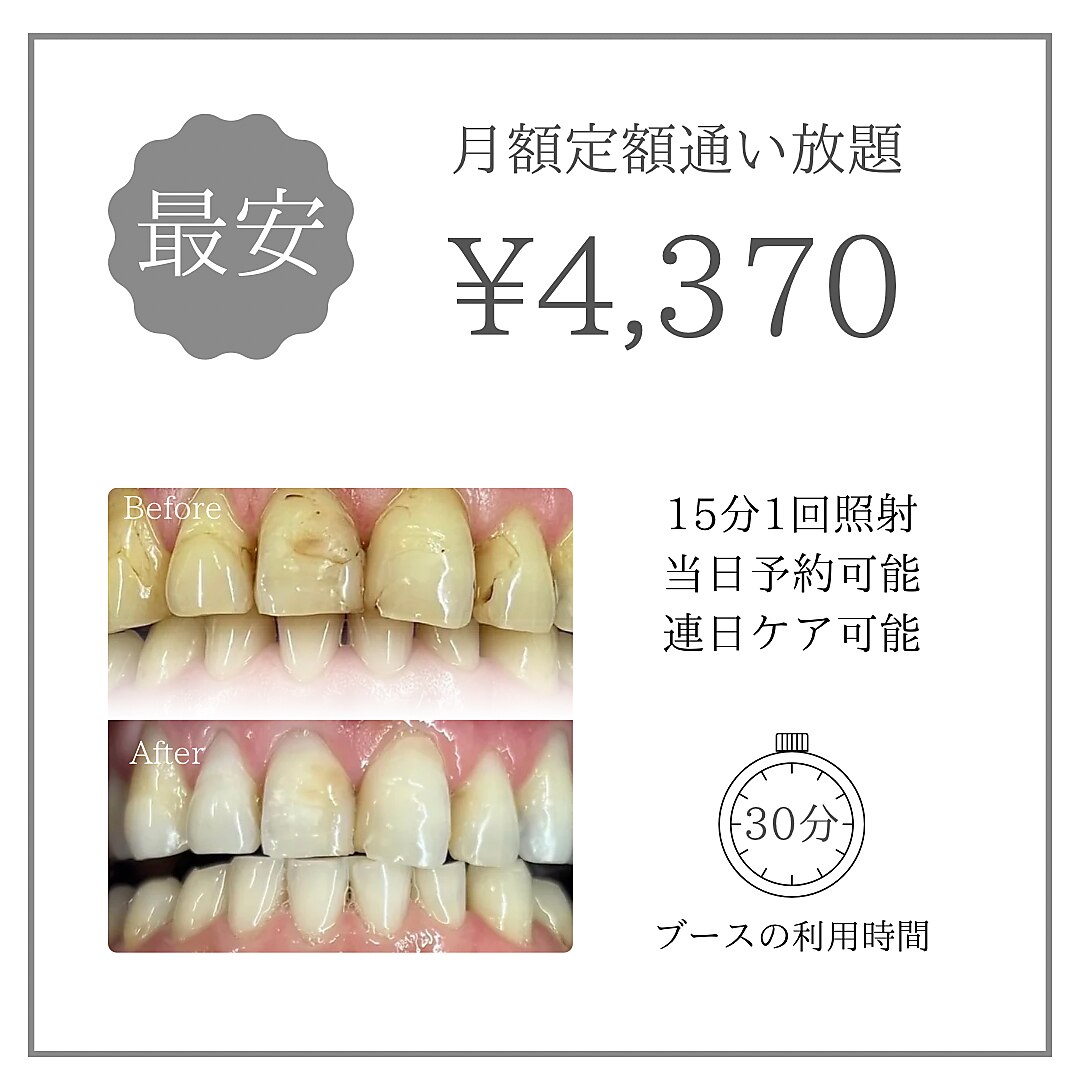 【月額通い放題】心斎橋No.1★歯科提携・毎日通えて4,370円〜！口コミ高評