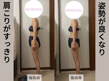 モモナ(Momona)/#肩こり#リンパマッサージ#野並