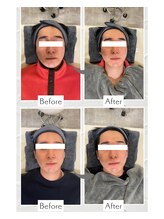 リノ ショウナン(LINO SHONAN)/ポテンツァモニター様