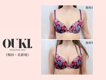 オウキ 梅田北新地(OUKI.)/バストアップ結果写真