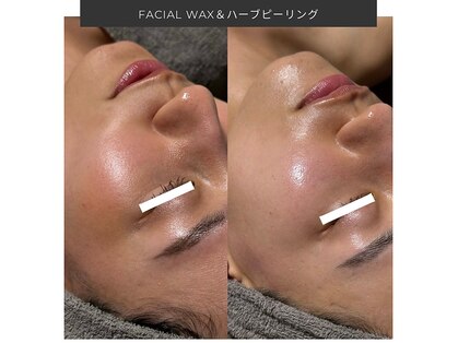 エステ リラクゼーションサロン(more)の写真