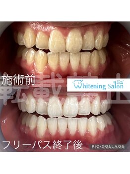 ホワイトニングサロン 名古屋 栄店の写真/【名古屋・歯科提携サロン】高い実績口コミエリアTOPレベル!丁寧なカウンセリングでホワイトニング初心者◎