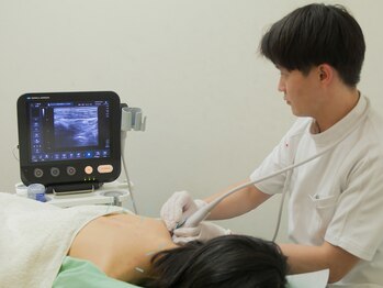 名古屋トリガーポイント鍼灸院/ 首・肩・頭の施術