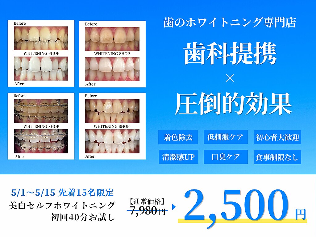 ホワイトニングショップ 茨木店｜ホットペッパービューティー