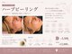 エピル(EPIL)の写真