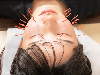 整骨院鍼灸院アシスト/1番人気！！美容鍼♪